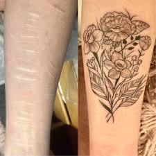 Results are instantaneous and last up to 3 years without ever washing off. Floral Scar Cover Up Jacki O Rourke Hot Rod Tattoo Blacksburg Va Tattoos