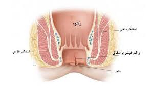 We did not find results for: Ø¯Ø±Ù…Ø§Ù† Ú¯ÙˆØ´Øª Ø§Ø¶Ø§ÙÙ‡ Ù…Ù‚Ø¹Ø¯ÛŒ Ù„ÛŒØ²Ø± Ø²Ø§Ø¦Ø¯Ù‡ Ø§Ø·Ø±Ø§Ù Ù…Ù‚Ø¹Ø¯ Ø¹Ù„Øª Ø¹Ù„Ø§Ø¦Ù… Ùˆ Ù‡Ø²ÛŒÙ†Ù‡ Ú©Ù„ÛŒÙ†ÛŒÚ© Ø¹Ø§Ø¨Ø¯ÛŒØ§Ù†