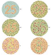 Detailed a screening test may be able to detect color blindness, but a more detailed color blind test is needed to measure how severe the condition is. Color Blindness Test