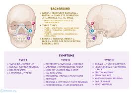 Image result for Fracture Types