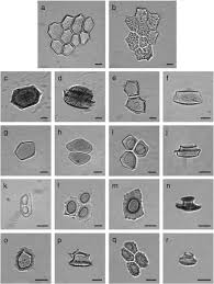 Image result for Stanfieldiella imperforata
