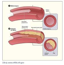 Image result for cukrovka hodnoty tabulka
