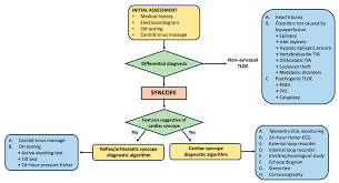 Image result for Exercise Induced Syncope