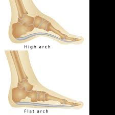Maybe you would like to learn more about one of these? Flat Feet Posterior Tibal Tendon Dysfuction Pttd Idaho Foot Ankle Center
