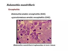 Image result for Entada bacillaris