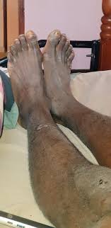 She grabs her feet and crys, she just needs someone to help her. Shash Na Lipgloss On Twitter Chris Brown Is Better Than Beyonce I Prefer Women Who Don T Wear Make Up Or Weaves White Toe Nails On Girls Only It S Not Fatphobia