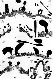 Image result for Ophrestia unicostata