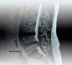 Welcome to new choice health where we help you make informed decisions about your medical procedures by giving you the tools you. Mri Scan Cost Vaidam Com