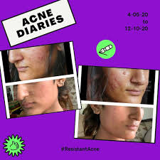 2159 Reviews for Dr. Ayesha Faizan (Indian Skin Clinic) in Mankapur, Nagpur 