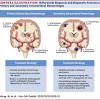 L'emorragia cerebrale può essere intracerebrale (da rottura dell'arteria di charcot in corso di crisi ipertensiva o da rottura di angiomi o. Https Encrypted Tbn0 Gstatic Com Images Q Tbn And9gcse9urofcpahv5txzyvgpibmrrlnfcfdhzvfn4esigbcpcxfloh Usqp Cau