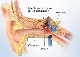 Image result for Acute Otitis Externa