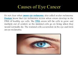 Eye cancer, also known as ocular cancer, is rare, with around 430 cases diagnosed in the uk each year. Eye Cancer Eye Melanoma Symptoms Causes Diagnosis And Treatment