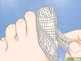 Suggest treatment for ingrown toenail. How To Help A Toenail Grow Back Quickly 15 Steps With Pictures