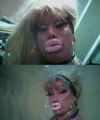 Desastres titânicos da cirurgia plástica