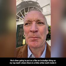 Rory McCormick’s practice, 55 Wimpole Street for treatment of a tooth  implant done 15 years ago which has now caused peri implantitis., ., ., .,  ., ., ., ., ., ., ., ., ., ., #lukecascarini ...