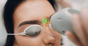 To reduce any discomfort, apply ice to the treated area. Yes Laser Facial Hair Removal Is A Thing Australian Skin Clinics
