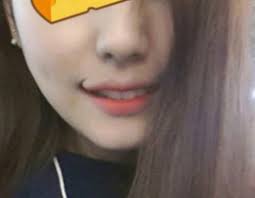 Photo Is This Bizarre Smile A Result Of Plastic Surgery Curling Lip Corners Up For Permanent Smiling Ick Plastic Surgery Korean Plastic Surgery Surgery