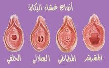 ليلة الدخله ملف شامل ونصائح هامة وتفاصيل فى ليلة الزفاف وكيف تتم