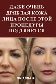 уход за кожей лица после 30 в домашних условиях Kak Mozhno Sohranit Molodost Lica Ne Poseshaya Dorogie Salony Krasoty I Plasticheskogo Hirurga Zdes Samye Effektivnye Domashnie S Lico Podtyazhka Kozhi Chistoe Lico