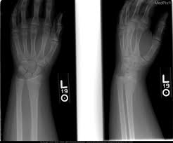 We did not find results for: Frontal Lateral And Oblique Images Of The Distal Fore Open I