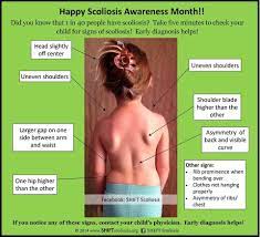 If you suspect your child might have scoliosis, make an appointment with a doctor right away. June Is Scoliosis Awareness Month Check Your Kids We Do Not Have School Screening In Canada Scoliosis Awareness Month Scoliosis Awareness Public Health Nurse