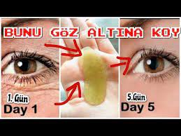 Bu Jel Pedleri Goz Altima Koydum Kirisiklik Ve Morluk Aninda Bitti En Etkili Dogal Goz Alti Bakim Youtube Dogal Dogal Cilt Bakimi Cilt Bakimi
