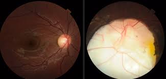 The Pan African Medical Journal Image Quiz