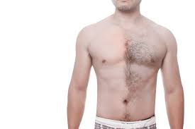 Still, it's usually worth the money. Laser Hair Removal Cosmetic Expert