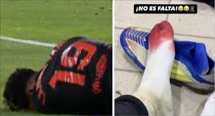 😳🩸 Lamine Yamal shows BRUTAL aftermath of a Las Palmas defender stomping  on his foot — Tribuna.com