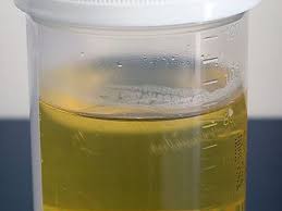 Find details on discolored urine in dogs including diagnosis and symptoms, pathogenesis, prevention, treatment, prognosis and more. What S The Normal Color Of Dog Urine Dog Discoveries