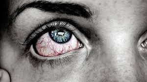 Check spelling or type a new query. 11 Penyebab Mata Sakit Saat Berkedip Dan Cara Mengatasinya Hot Liputan6 Com