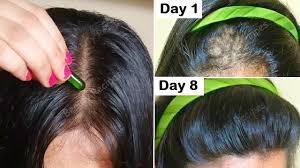 We did not find results for: Vitamin E For Hair Loss Kobo Guide