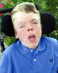 Davis Seefeldt Obituary