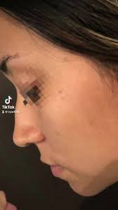 Dr. Christopher Yong Wong- Medicina estética y medicina regenerativa