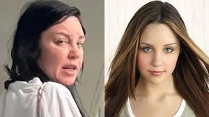 Slávna herečka: Po liečbe na psychiatrii vyzerá ako... Wau!