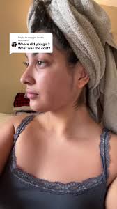 Chin Lipo Recovery Tips and Insights