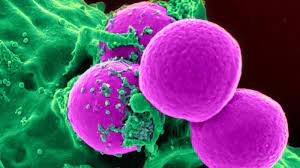 Apr 21, 2021 · what is mrsa? Mrsa In The Family Mine Helix Magazine