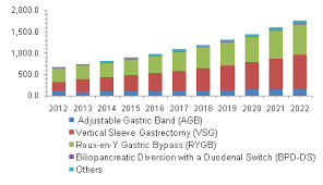 Us And Canada Bariatric Surgery Market Bariatric Surgery Vertical Sleeve Gastrectomy Sleeve Gastrectomy
