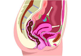 El sistema reproductor femenino esta compuesto por los ovarios, trompas uterinas o trompas de falopio, utero o matriz y la vagina. Cancer De Cuello De Utero Que Sintomas Tiene Hospital Fuensanta Madrid