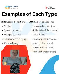 Image result for Neurologic Lesion Localization