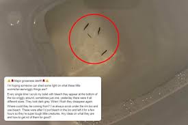 Check spelling or type a new query. You Could Get Black Toilet Worms In Your Loo Even After It S Been Bleached But This Is How To Get Rid Of Them