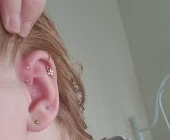 Help Top Forward Helix Piercing Is Being Eaten Was Fine Yesterday And Today It Has Decided To Sell And Grow Over The Top Going To A Piercer Today But I Don T Have