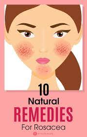10 Natural Remedies To Manage Rosacea Types Symptoms And Causes Natural Remedies For Rosacea Rosacea Skin Care Redness On Face