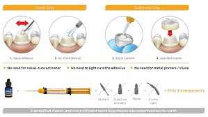 The mixture in the second method contained common salt as an essential ingredient, and some material which would assist in giving off hydrochloric acid and chlorine, also an absorbent for the fusible salts which liquidated out. Nexus Universal Universal Adhesive Resin Cement Kerr Dental