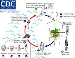 Internal structure of liver fluke with corresponding designations. Fluke Infections Of The Liver Infections Merck Manuals Consumer Version