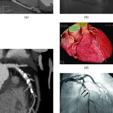 128 256 And 320 Slice Ct Scanner Characteristics For Four Main Download Table