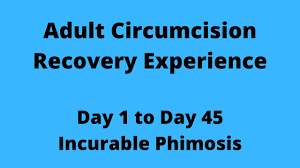 Check spelling or type a new query. Adult Circumcision Recovery Experience Day 1 To Day 45 Phimosis Youtube