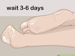 Once it does, remove the diy foot peel for instantly softer feet. How To Use An Exfoliating Foot Peel 10 Steps With Pictures