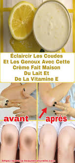 Eclaircir Les Coudes Et Les Genoux Avec Cette Creme Fait Maison Du Lait Et De La Vitamine E Eclaircir Coudes Genoux Creme Vitamin E Santee Vitamins