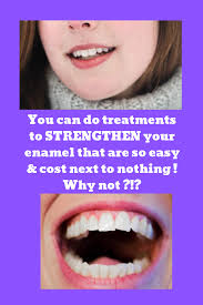 'this depends on the removal option you take. How To Strengthen Tooth Enamel Reddit Arxiusarquitectura